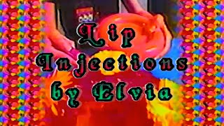 LIP INJECTIONS BY ELVIA [upl. by Krall]