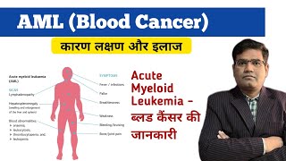 Acute Myeloid Leukemia AML Cause Symptoms Tests and Treatment Explained  Blood Cancer [upl. by Attela]