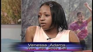 Sickle Cell Disease in Teens  Keeping Kids Healthy [upl. by Berte]