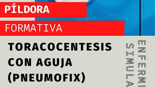 Toracocentesis con aguja Uso del pneumofix [upl. by Regnij]