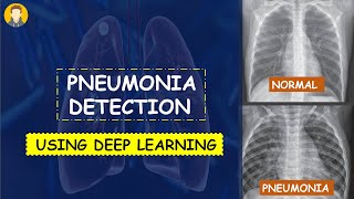 PNEUMONIA Detection Using Deep Learning in Tensorflow Keras amp Python  KNOWLEDGE DOCTOR [upl. by Dowd]