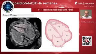 Ecocardiografía fetal  Dr Ximenes [upl. by Esinyl424]