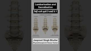 Sacralization and Lumbarization backpainrelief vertigo jassfitness shorts lowerbackpain gym [upl. by Stoddart716]