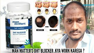 DHT Blocker Biotin Capsules to control Hair Thinning by Man Matters No Finasteride from now dht [upl. by Sivla569]