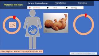 Cytomegalovirus during pregnancy [upl. by Ragnar186]