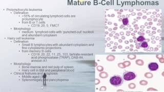 Mature Lymphoid NeoplasmsSimple One1 [upl. by Aivatahs]