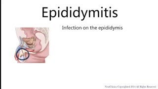 Epididymitis [upl. by Euqinobe611]