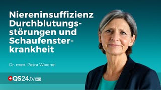 Niereninsuffizienz Durchblutungsstörungen und Schaufensterkrankheit  Dr med Petra Wiechel  QS24 [upl. by Inihor597]