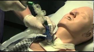 Closed suction of a tracheostomy tube [upl. by Oicnerolf]