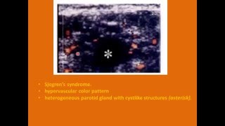 SALIVARY GLAND ULTRASOUND [upl. by Itisahc]