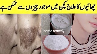 Hyperpigmentation  Melasma spots  Home Remedy [upl. by Laohcin]