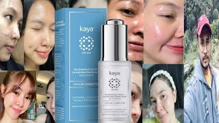 Kaya 5 Glycolic Acid 1 Polyglutamic Acid Face Serum  Honest Review [upl. by Welbie]