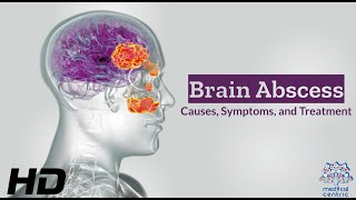 Brain Abscess Unveiled Causes Symptoms and Lifesaving Treatments [upl. by Betti973]