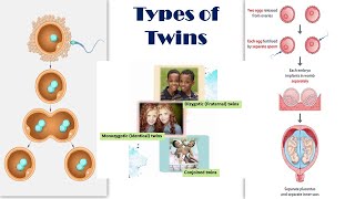 Types of Twins  Dizygotic Fraternal vs Monozygotic Identical Twins  Conjoined twins [upl. by Ardnuat]