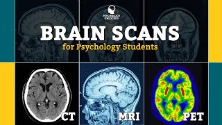 BRAIN SCANS FOR PSYCHOLOGY STUDENTS  CT MRI fMRI PET  Neuroscience [upl. by Walke]