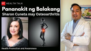 Pananakit ng balakang Hip Pain  Sharon Cuneta may Osteoarthritis [upl. by Akibma]