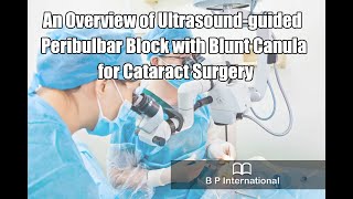 An Overview of Ultrasoundguided Peribulbar Block with Blunt Canula for Cataract Surgery [upl. by Layap448]