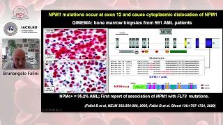 joint IACRLRDIACH webinar Targeted diagnosis and therapy of NPM1mutated AML [upl. by Ruddie511]