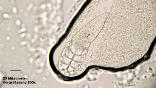 DemodexMilbe 2min Bauchbewegung beobachten [upl. by Kcired]