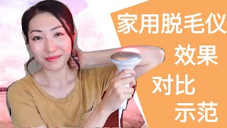 家用脱毛仪测评和示范  Philips Lumea IPL  剃毛刀脱毛膏私密好物推荐 [upl. by Okime]