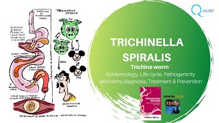 Trichinella Spiralis Parasitology simplified tutorials For NEXT USMLE NEET PG PLAB [upl. by Hajin]