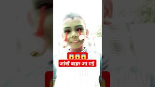 😱Eyes Popped Out shorts short youtubeshorts shortfeed youtubeindia eyes [upl. by Florie]