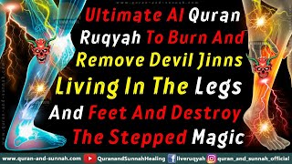 Ruqyah Dua To Burn And Remove Devil Jinns Living In The Legs And Feet And Destroy The Stepped Magic [upl. by Joan]