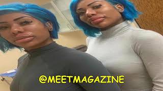 Clermont Twins new faces Plastic surgery has fans roasting them on Instagram War On Pretty [upl. by Wickner861]