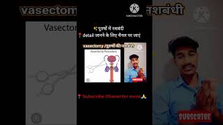 💉नशबंदीvasectomy medical procedureanatomypopularmosttrendingwowviralvideo [upl. by Alyaj]