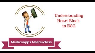 Understanding Heart Block in ECG [upl. by Ajak474]