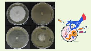 Evaluación de consorcio bacteriano contra Fusarium oxysporum f sp lycoperisici [upl. by Sansen]