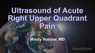 Ultrasound of Acute Right Upper Quadrant Pain [upl. by Kolosick]