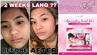 2 Weeks of Using BRILLIANT SKIN REJUVENATING SET  Honest Review [upl. by Ecinaej246]