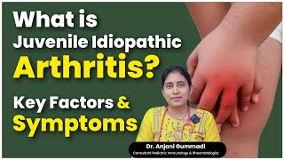 What is Juvenile Idiopathic Arthritis  Dr Anjani Gummadi  Ankura Hospitals [upl. by Enorel]