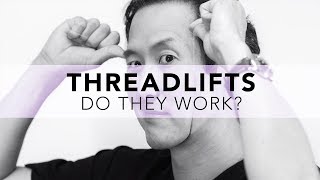 What is the REAL truth about Threadlifts No spin here [upl. by Dleifxam]