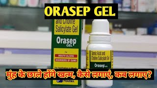 Orasep Gel l Price Uses in hindi l How to Use l Elan Pharma l [upl. by Mayram]