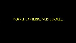 19 Doppler de arterias vertebrales  Dr González [upl. by Aniroz]