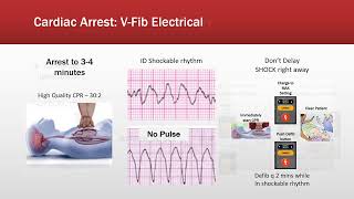 Cardiovascular treatments 4 [upl. by Klump]