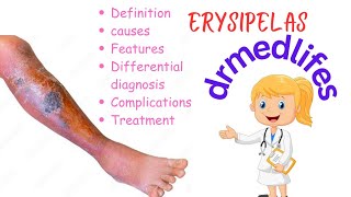 Erysipelas causes symptoms differential diagnosis complications treatment [upl. by Ursal]