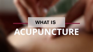 Demystifying the Role of Acupuncture for Pain Management [upl. by Nylac140]