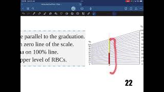 Hematocrit value  Practical hematology  Dr Saiko [upl. by Norrag]