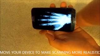 Xray body scanner simulator for ANDROID [upl. by Nilrev608]