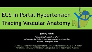 Endoscopic Ultrasound Evaluation of Splenoportal Axis in Portal Hypertension [upl. by Nirik]