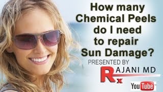 Chemical PeelsHow Many Do I NeedRepair Sun Damage [upl. by Deonne]