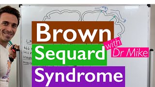 Brown Sequard Syndrome [upl. by Smart283]