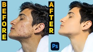 Clean and smooth skin in Photoshop 2024 😱🔥 [upl. by Millda]