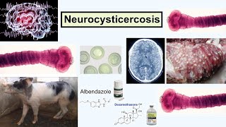 neurocysticercosis [upl. by Halivah]