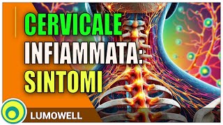 Cervicale Infiammata Sintomi [upl. by Aggi]