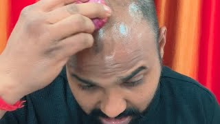 how to use adivashi hairoil original part2 आदिवासी oil adivasi hair oil original viral jhansi [upl. by Eirallam54]