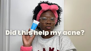 watch this cleanser transform my acne skin sped up version [upl. by Monika]